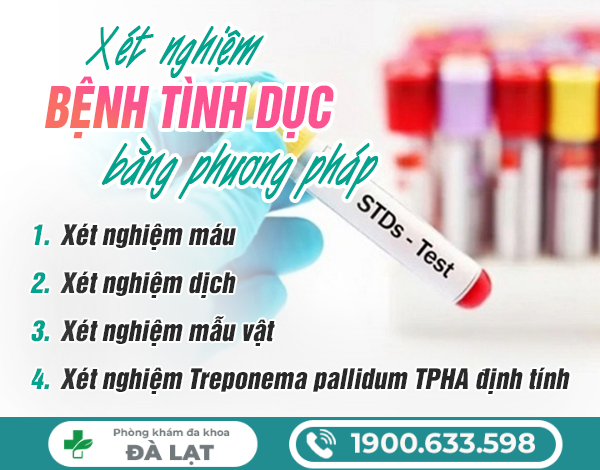 Hình ảnh minh họa